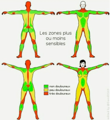 zones douloureuses sm